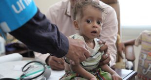 الحرب تسلب المستقبل من أطفال اليمن