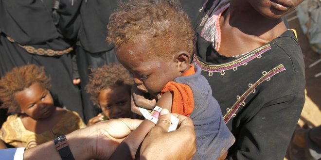 طفل يمني يتلقى العناية الطبية