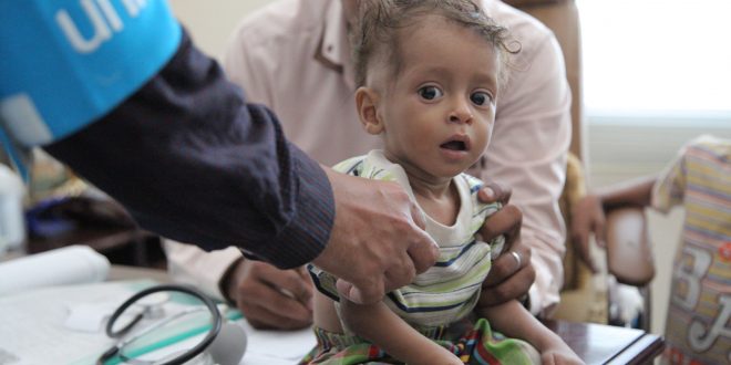 الحرب تسلب المستقبل من أطفال اليمن