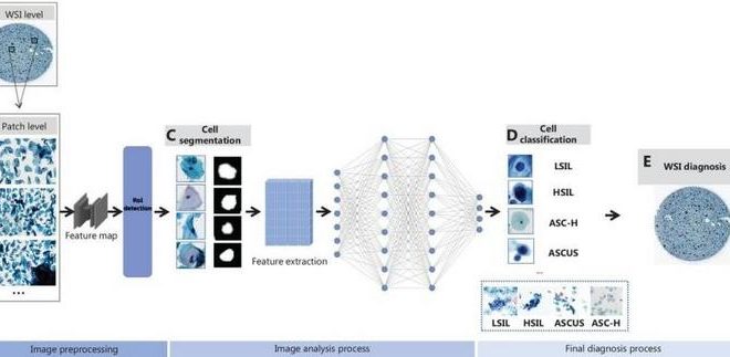 تمثيل تخطيطي لتحليل صور الخلايا العنقية بمساعدة الذكاء الاصطناعي